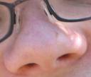 nose